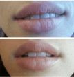 Rejuvenating Lip Treatment Online Hot Sale