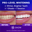 DiamondSeries® Teeth Whitening Kit with Hydroxyapatite & Potassium Nitrate Hot on Sale